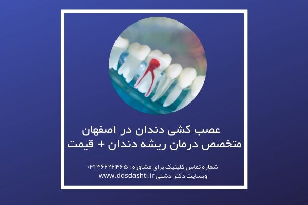 عصب کشی دندان در اصفهان | متخصص درمان ریشه دندان + قیمت