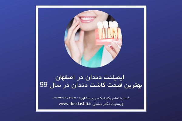 ایمپلنت دندان در اصفهان |بهترین قیمت کاشت دندان در سال 99