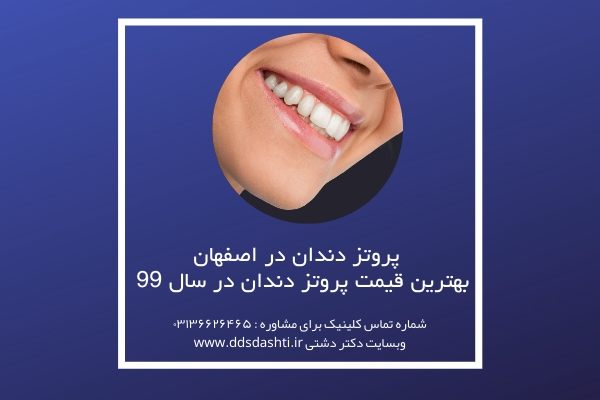 پروتز دندان در اصفهان | بهترین قیمت پروتز دندان در سال 99