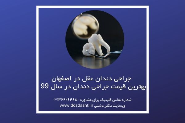 جراحی دندان عقل در اصفهان | بهترین قیمت جراحی دندان در سال 99