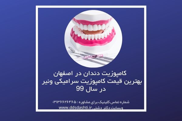 کامپوزیت دندان در اصفهان | بهترین قیمت کامپوزیت سرامیکی ونیر در سال 99